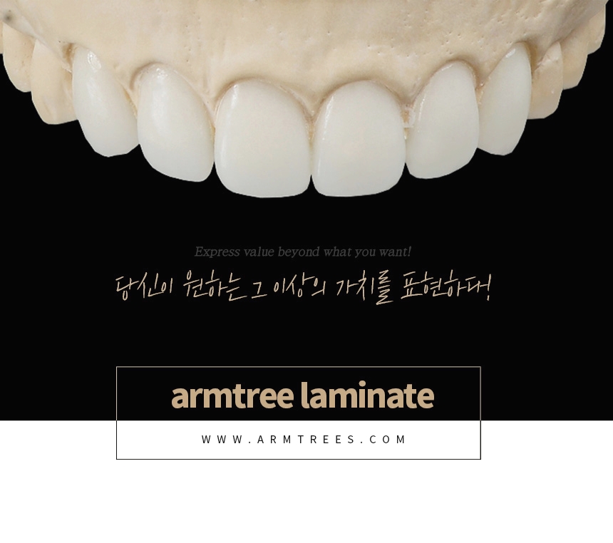 연예인라미네이트 신중하게 확인사항을 관련 이미지 9