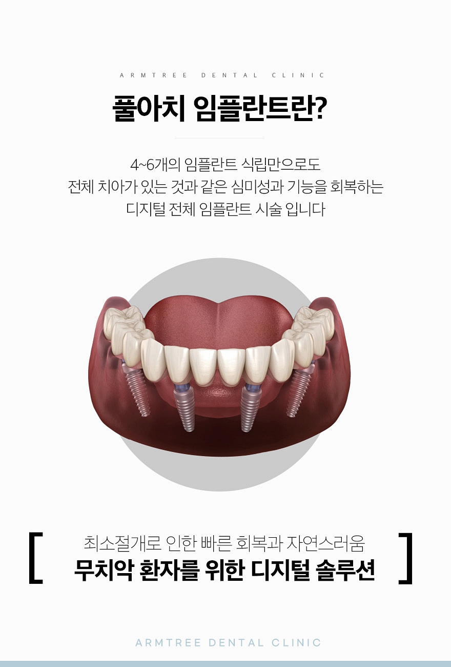 신논현역치과 전체임플란트가 궁금하다면 관련 이미지 3