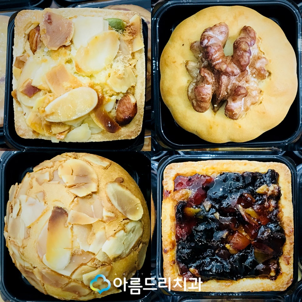 신경치료 아픈가요? 환자의 선물 관련 이미지 6