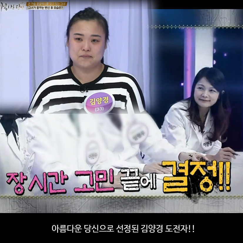 이현정원장의 아름다운 당신 시즌 2 (4회 김양경 도전자) 잇몸미백과 치아미백 관련 이미지 1