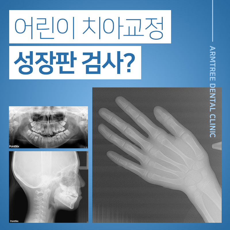 어린이치아교정 부정교합 성장판 검사 관련 이미지 1