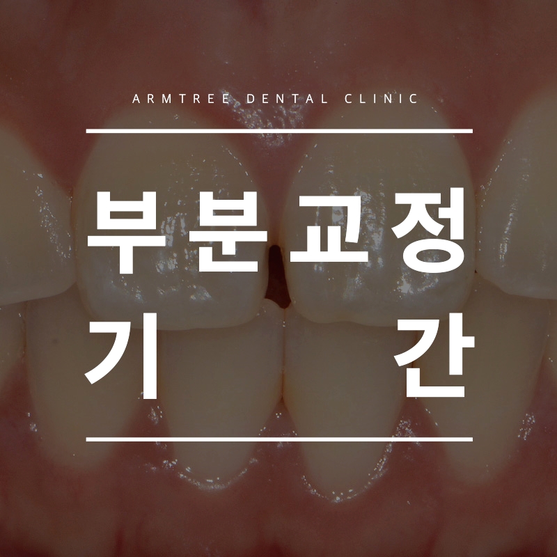 부분교정기간 신중하게 아름드리치과 관련 이미지 1