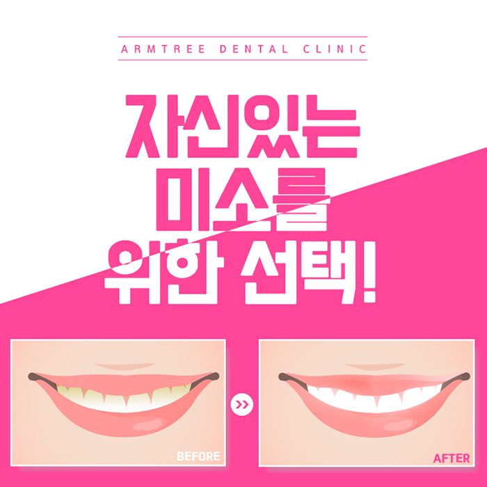 강남역 치아미백 연예인 인증한곳 관련 이미지 2