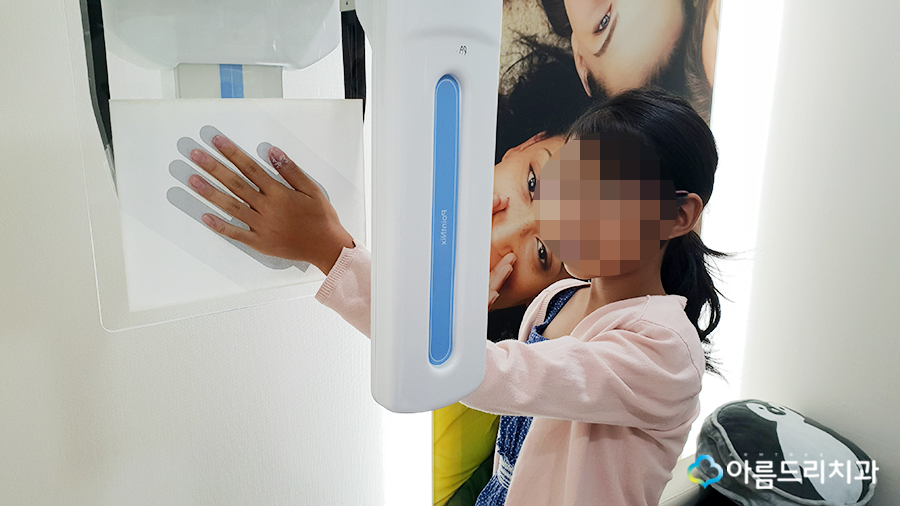 어린이치아교정 부정교합 성장판 검사 관련 이미지 13