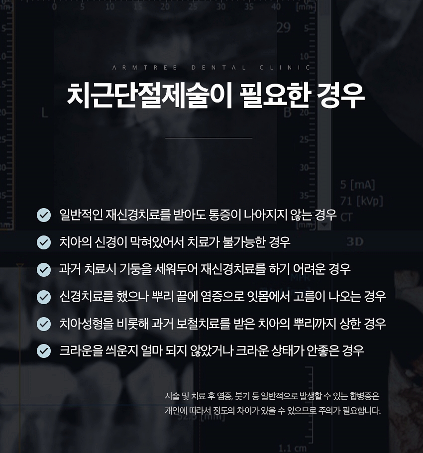치근단절제술 염증 신뢰있는 후기 아름드리치과 관련 이미지 8