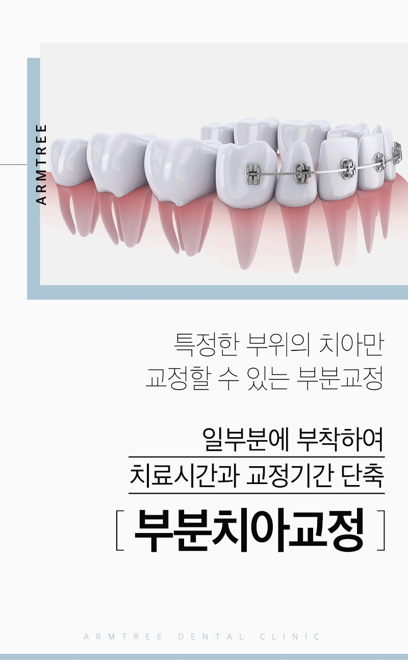 앞니부분교정후기 조화로운 아름드리치과 관련 이미지 2