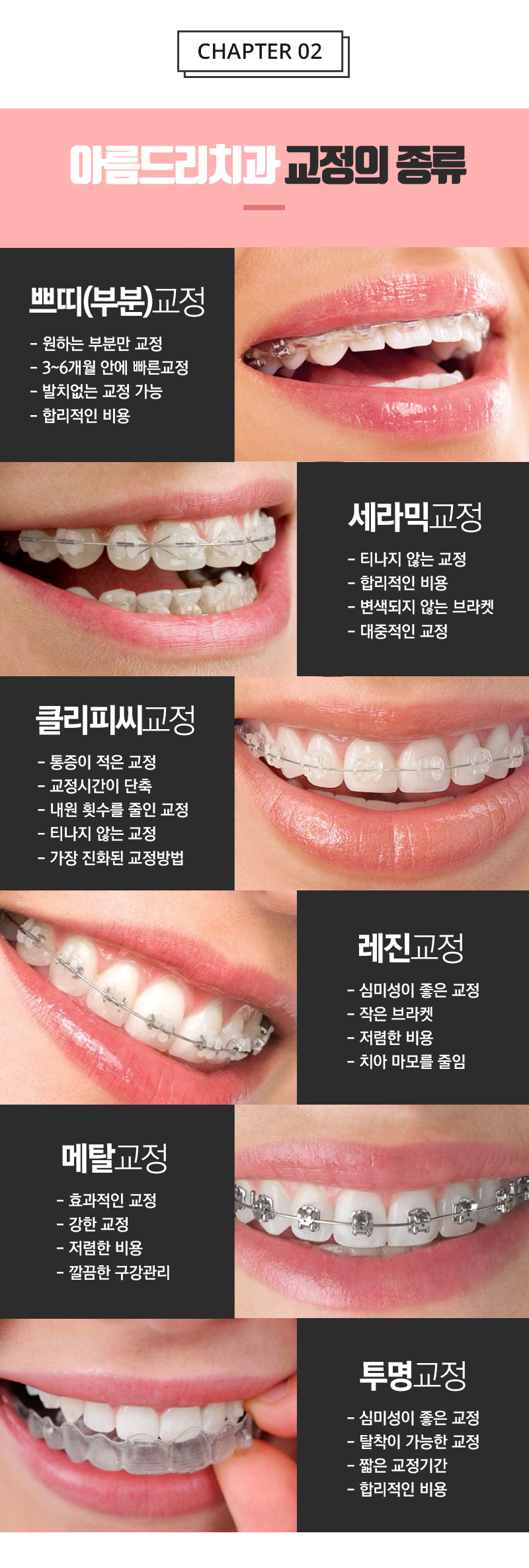 신논현치아교정 놀라운 효과 관련 이미지 4