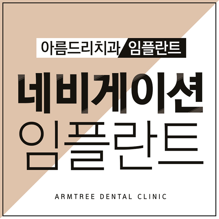 치아인플란트 네비게이션인플란트의 안전함 관련 이미지 1