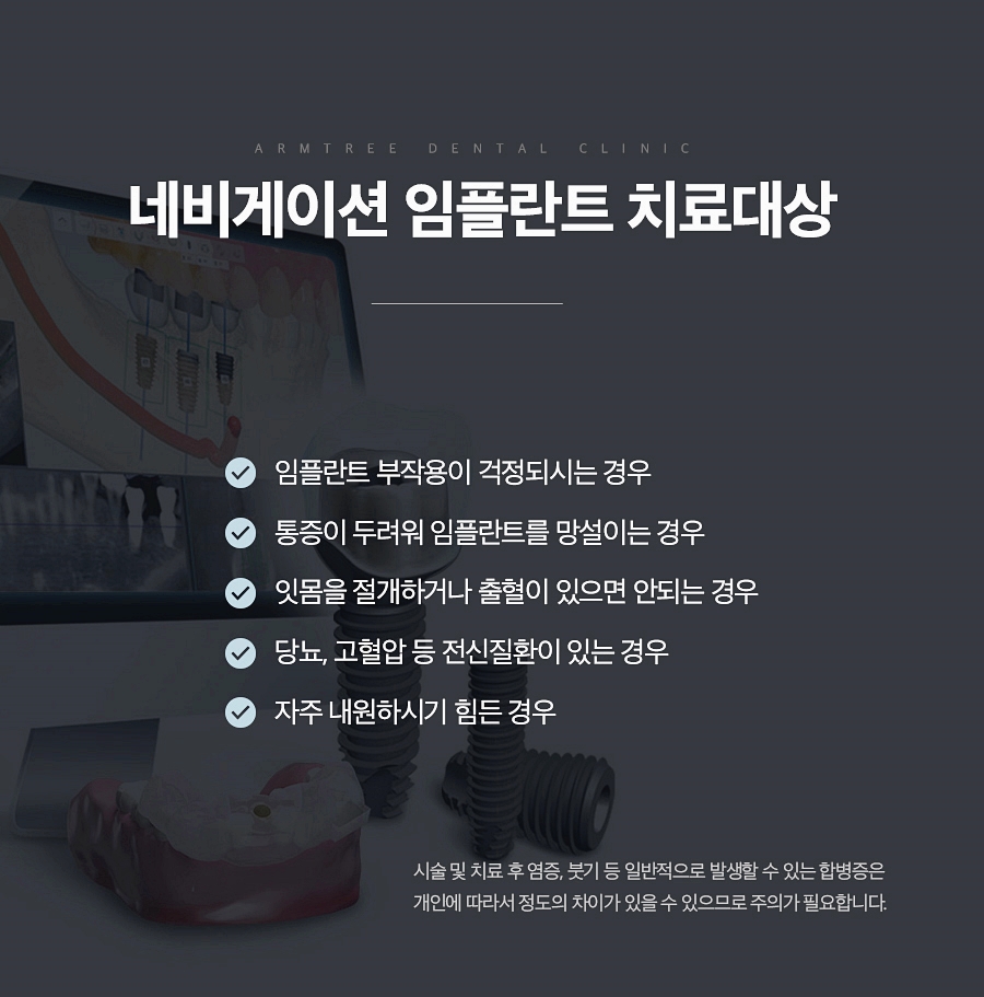 네비게이션임플란트 꼼꼼히 따져보면 관련 이미지 7