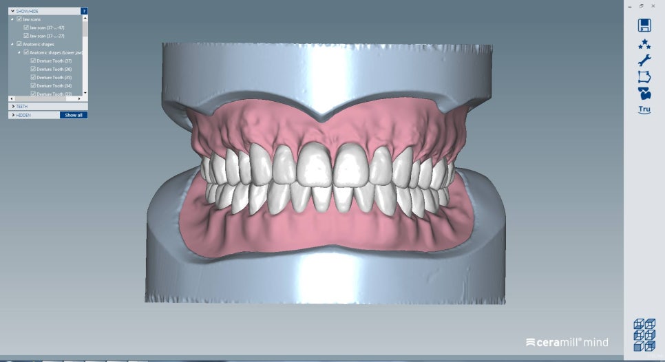 [신논현 치과] 3D 구강 스캐너_정확하게 본뜨기 관련 이미지 7