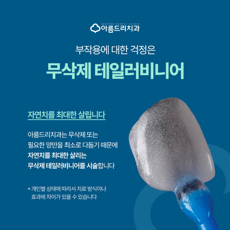 강남 무삭제라미네이트 A에서 Z까지 <테일러비니어> 관련 이미지 4