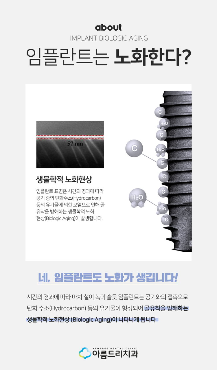 UV임플란트 더욱 완벽하게 관련 이미지 2