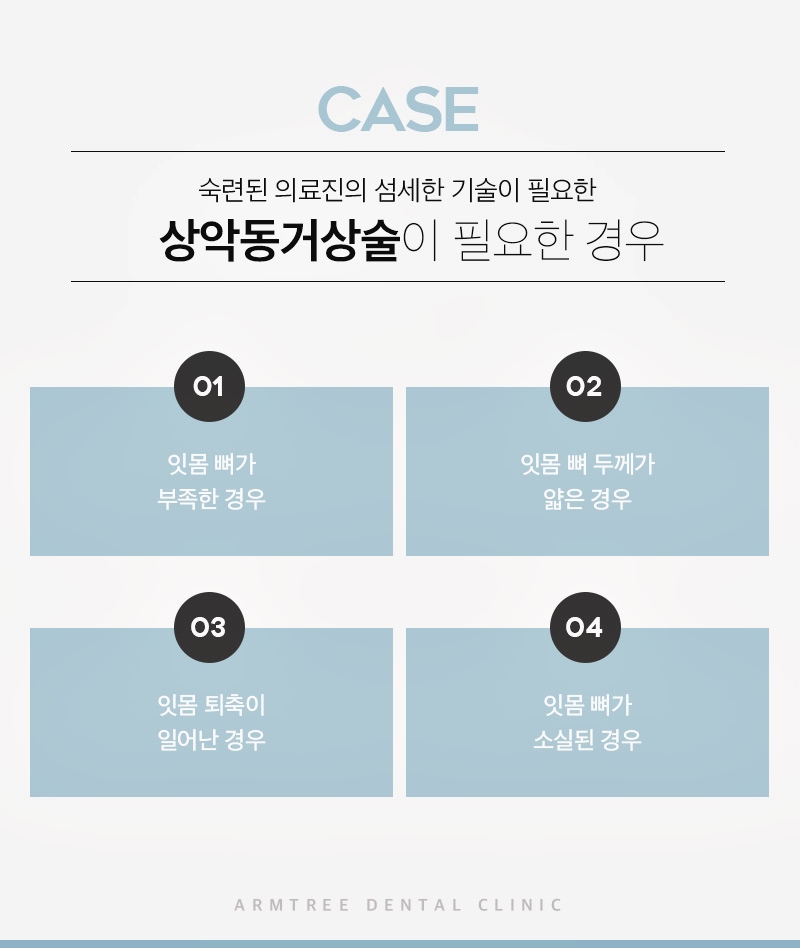 신논현치과 상악동거상술이 필요하다면 관련 이미지 6