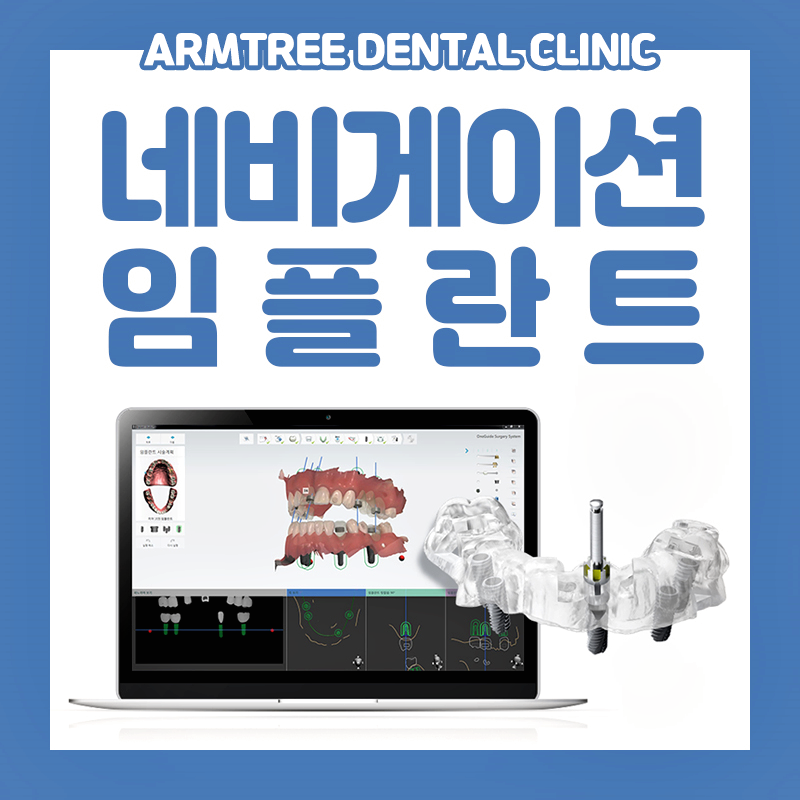 아름드리치과 임플란트의 안전성과 정확성을 높이다 관련 이미지 1