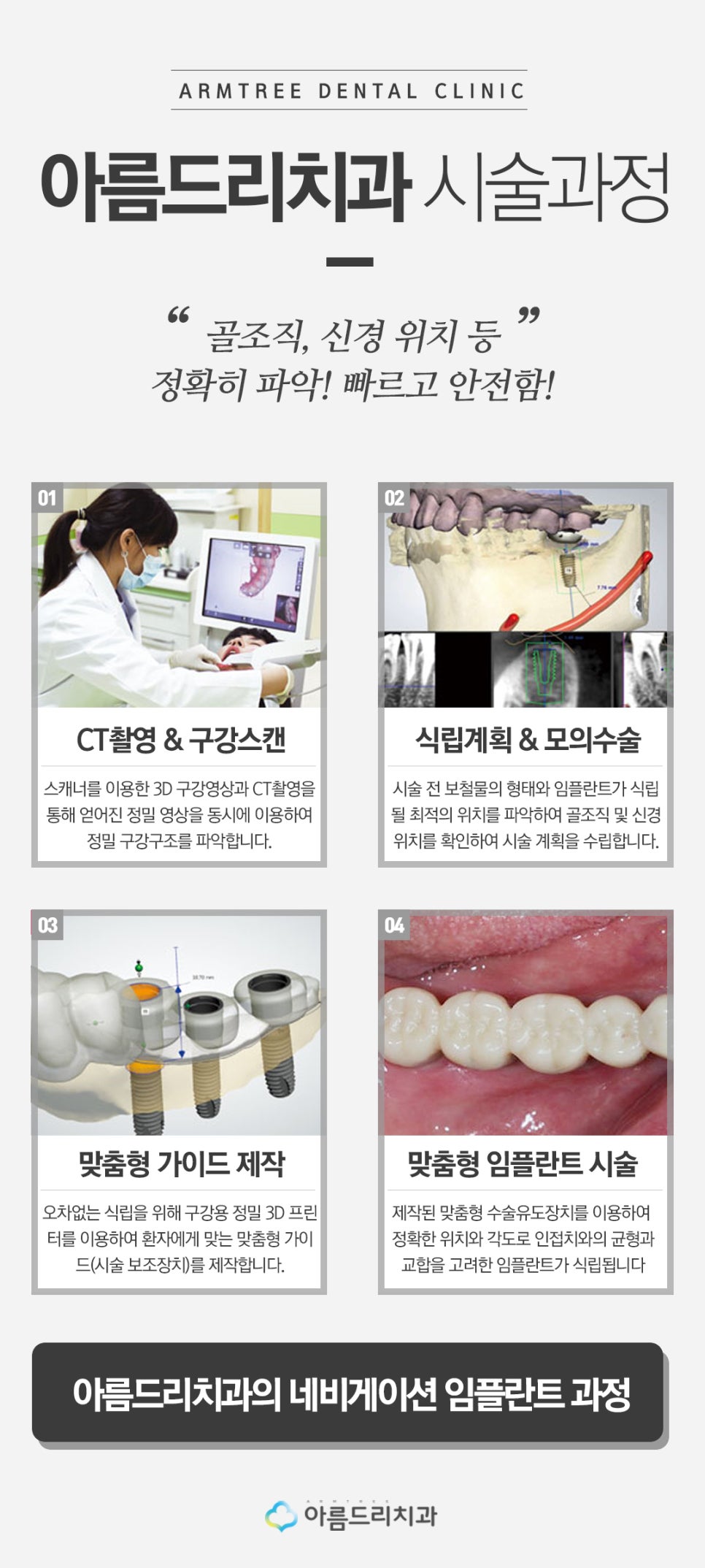 인플란트통증 네비게이션인플란트 걱정없음 관련 이미지 5