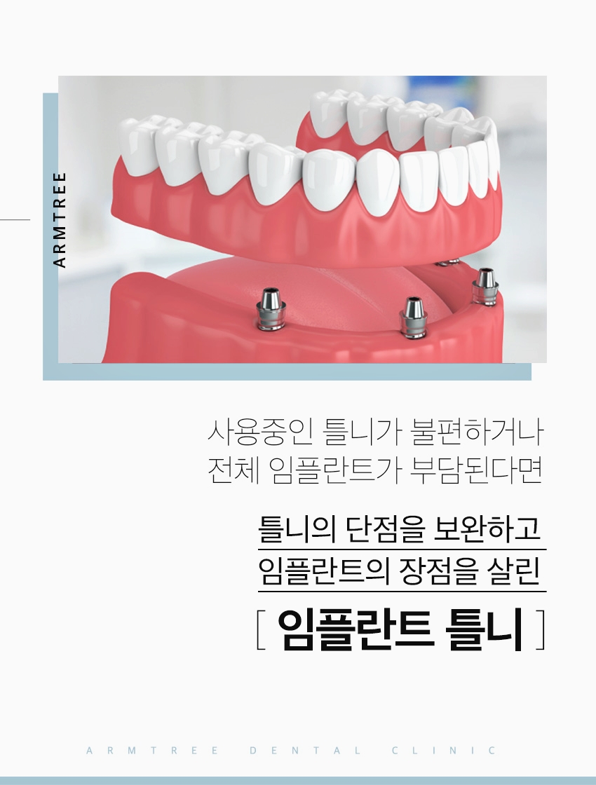 신논현치과 임플란트틀니로 치료부담을 줄인다면 관련 이미지 2