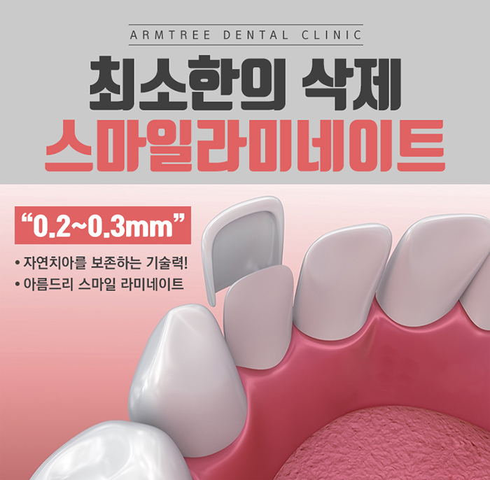 토끼이빨라미네이트 눈깜짝할 사이에 관련 이미지 5