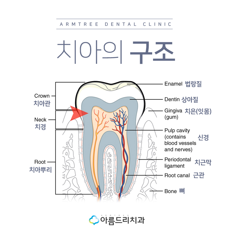 시린이 이시림치료 치경부마모증 관련 이미지 3