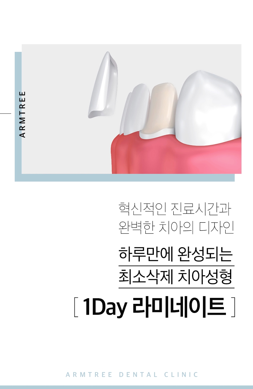 연예인라미네이트 신중하게 확인사항을 관련 이미지 2