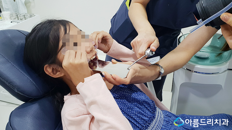 어린이치아교정 부정교합 리얼스토리#2 관련 이미지 3