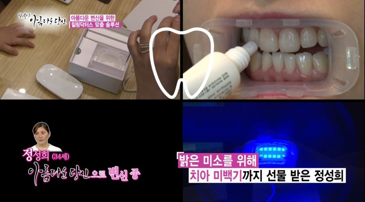 이현정 원장의 아름다운 당신 시즌 1 (8회 정성희 도전자) 임플란트, 신경치료, 치아성형, 올세라믹, 치아미백, 화이트랩스 관련 이미지 4