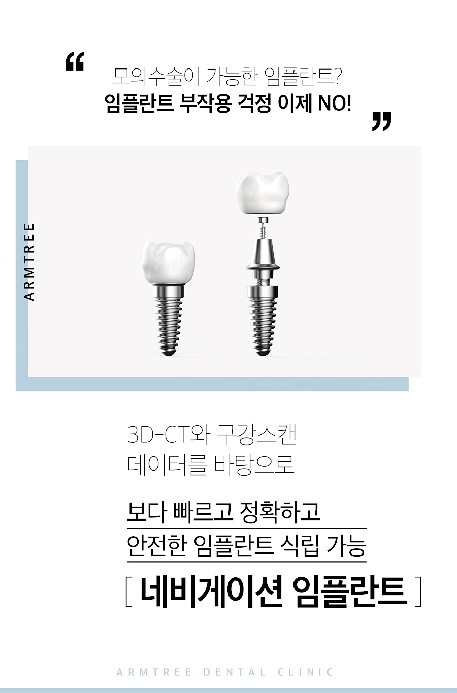 앞니임플란트 자연스러움을 원한다면 관련 이미지 2