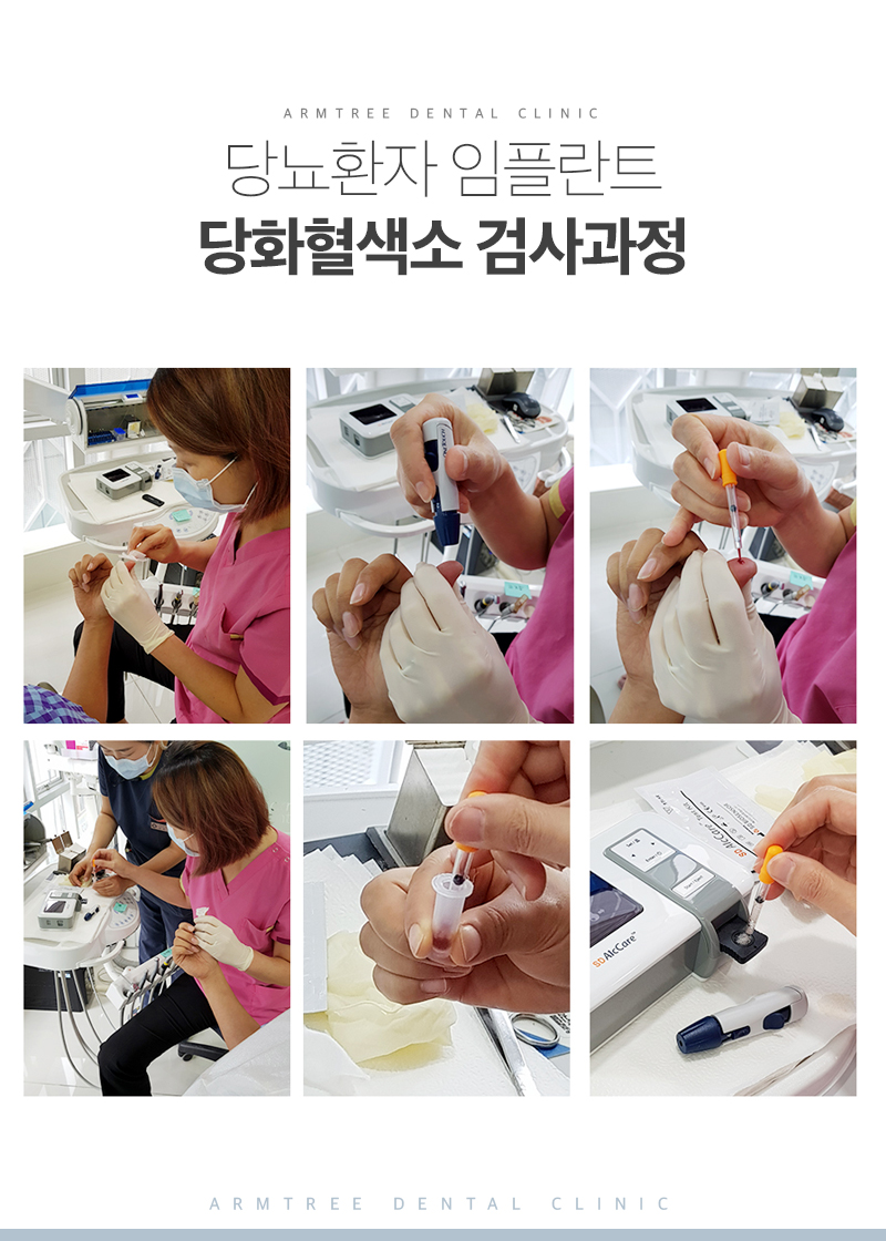 당뇨임플란트 치과 진료일기 관련 이미지 4