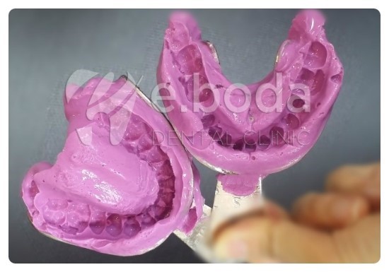 응답하라1988교정기녀 미옥이의 교정 이야기 관련 이미지 4