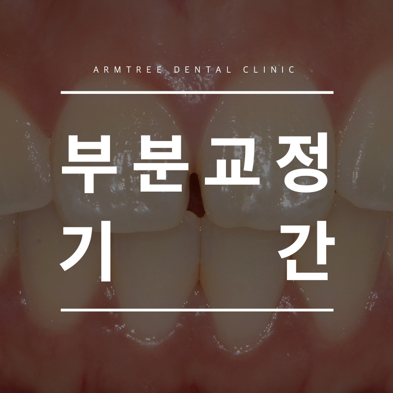 부분교정기간 다양한후기 아름드리치과 관련 이미지 1