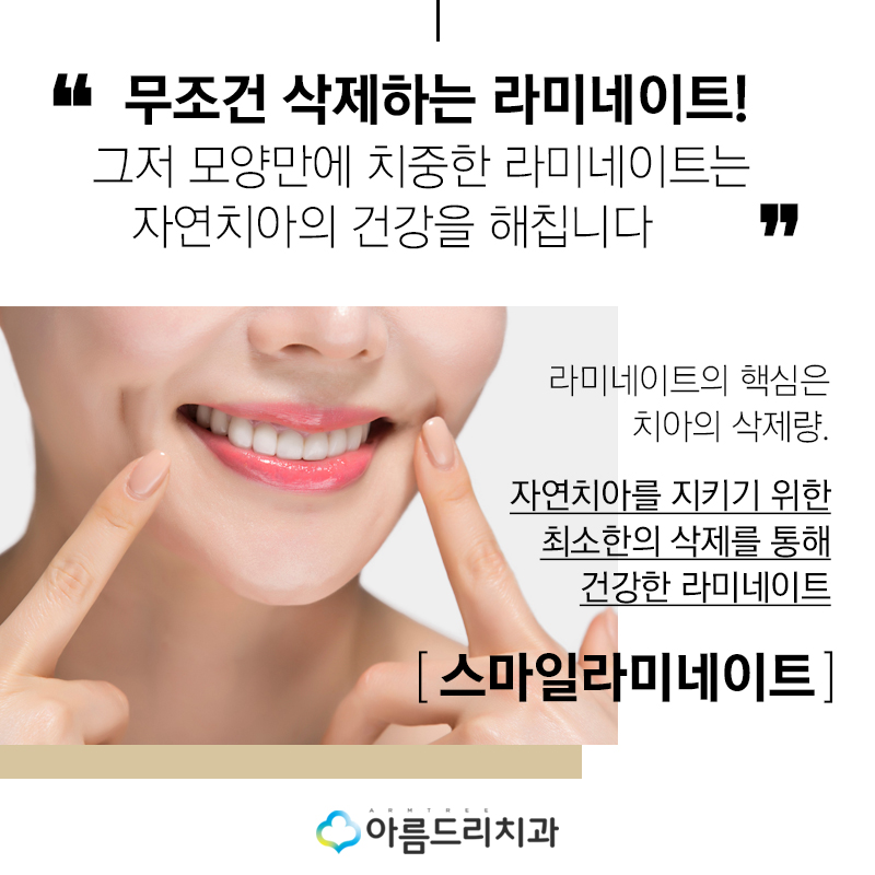 라미네이트연예인 이빨(치아) 최소삭제 이거다 관련 이미지 8