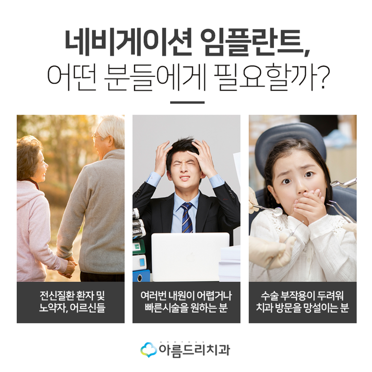 네비게이션임플란트 부작용은 저리가 관련 이미지 7