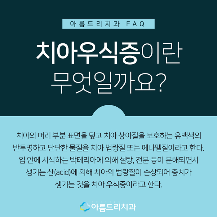 치아우식증 치료 증상과 예방법 관련 이미지 3