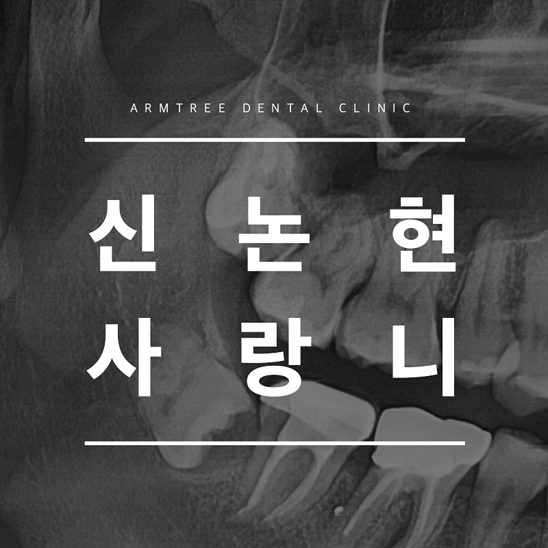 신논현 사랑니발치 선택하려면 관련 이미지 1