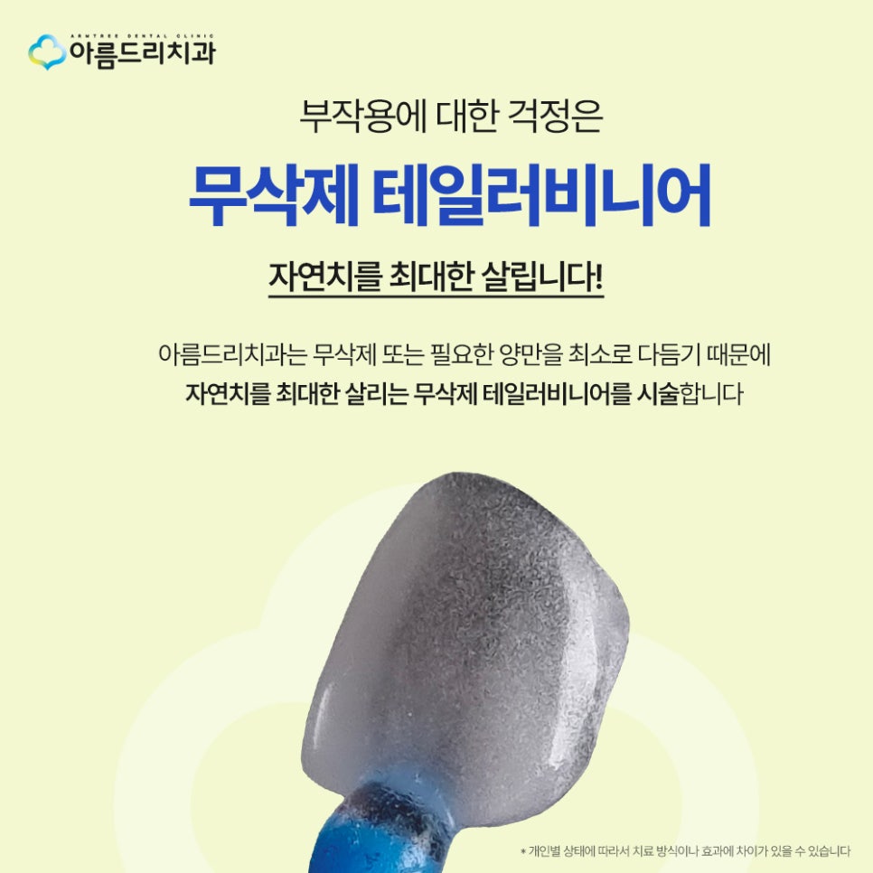 강남 라미네이트 부작용, 시림 현상, 깨짐, 탈락, 예방하는 방법 관련 이미지 2