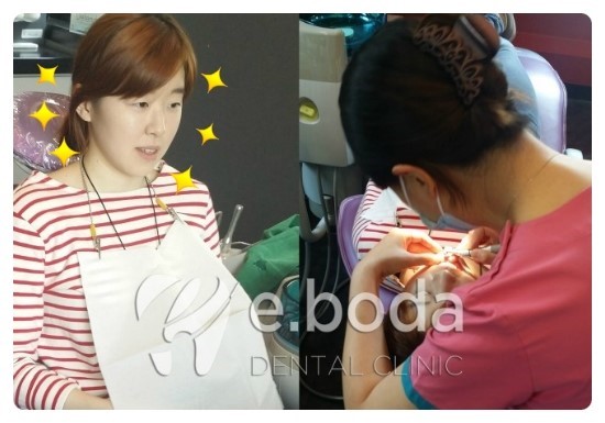 응답하라1988교정기녀 미옥이의 교정 이야기 관련 이미지 2