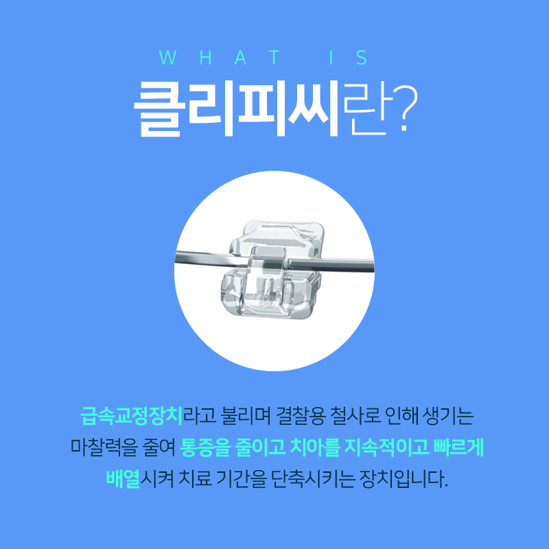 클리피시교정 후기와 기간 궁금해? 관련 이미지 2