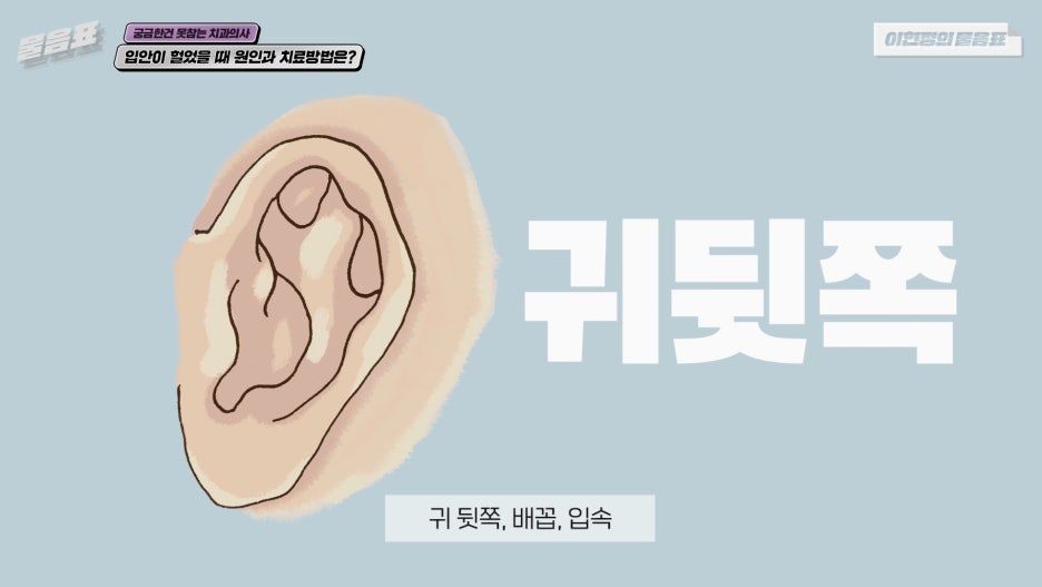 입안이 헐었을때 해결방법 이현정의물음표 관련 이미지 8