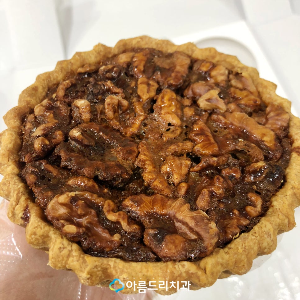 청소년치아교정 환자의 하남 마담파이 선물 관련 이미지 9