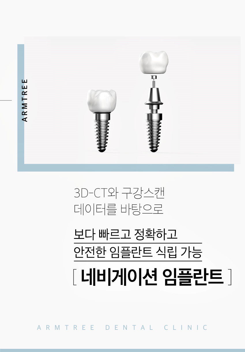 신논현역치과 임플란트 고민이라면 관련 이미지 2