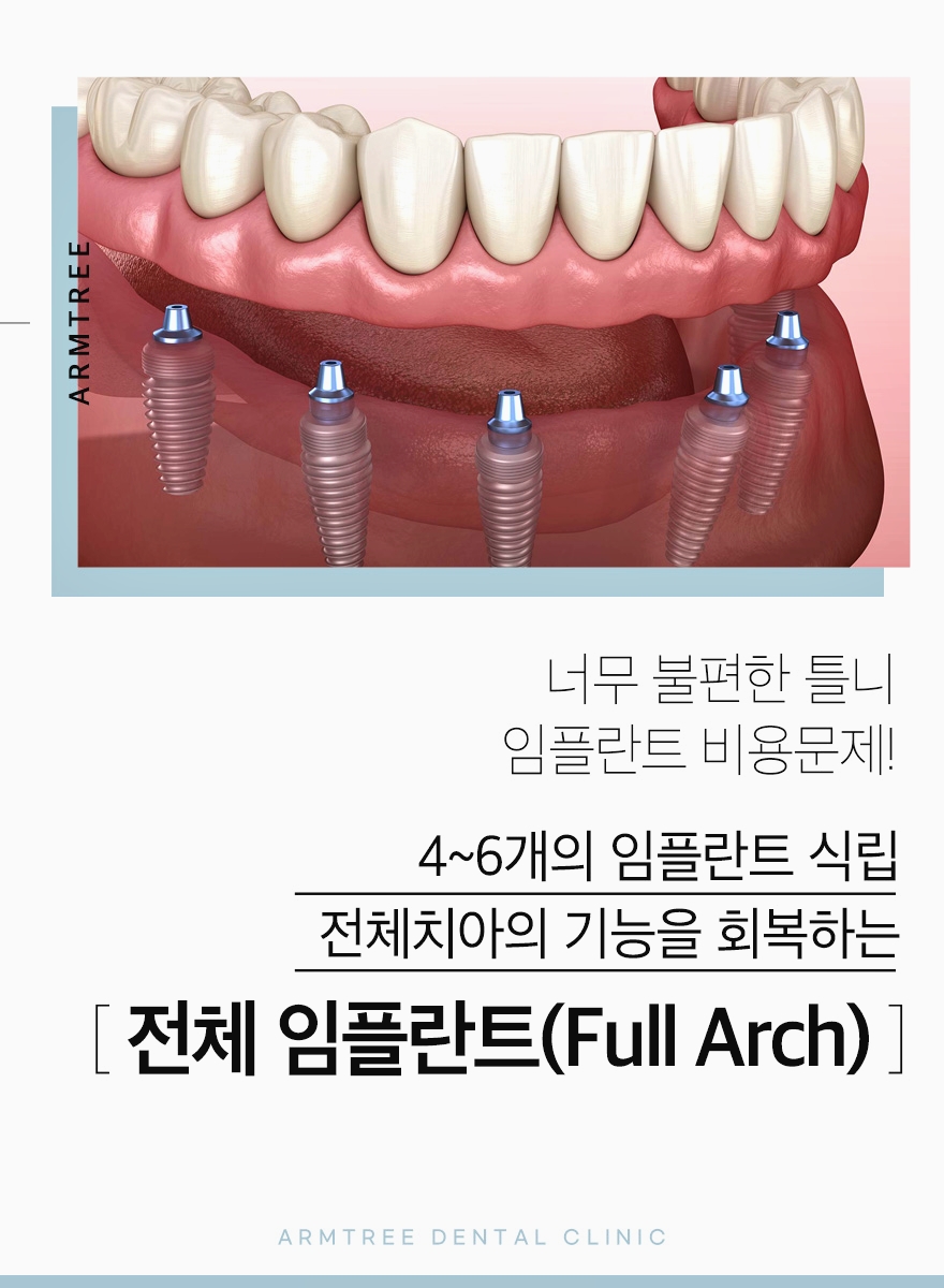 신논현역 전체임플란트는 풀아치임플란트로 관련 이미지 2