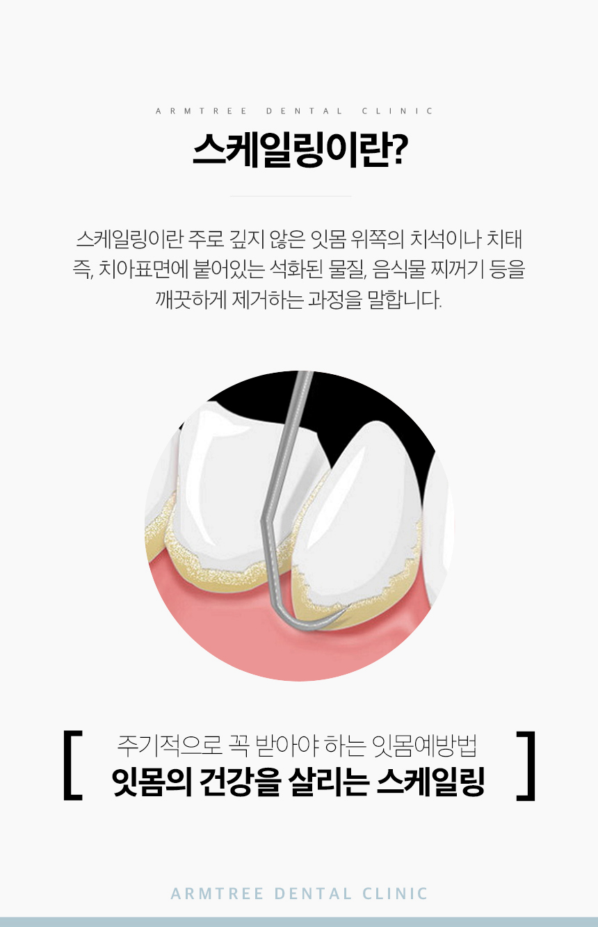 무통스케일링 안아픈치과 아름드리 관련 이미지 4