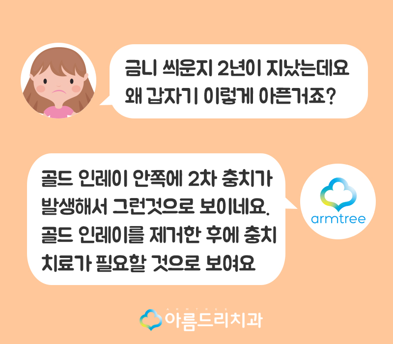 금니 2차충치 생기는 이유와 치료 관련 이미지 2
