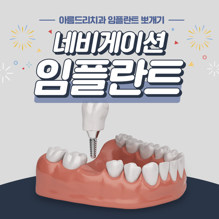 네비게이션임플란트 부작용과 통증놉 관련 이미지 1