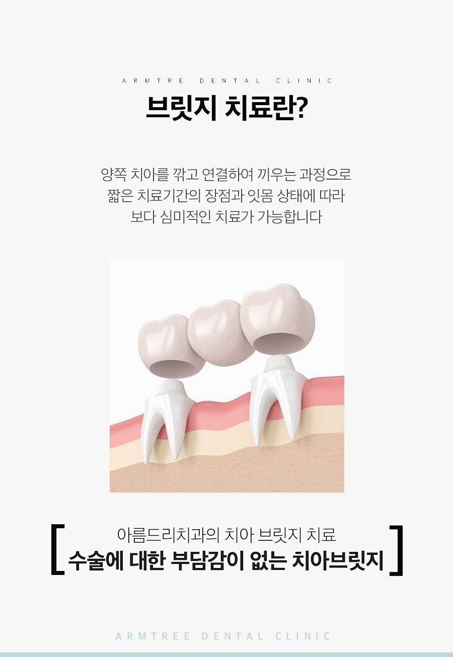 치아브릿지 가격 신논현역 아름드리치과 관련 이미지 2