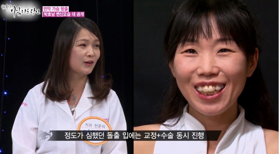 이현정원장의 아름다운 당신 시즌 1(4회 박효남 도전자) 돌출입 치아교정 관련 이미지 7