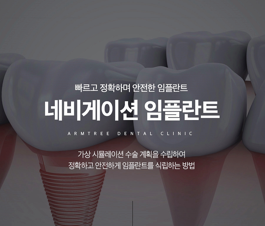 네비게이션임플란트가격 컴퓨터분석 신논현역치과 관련 이미지 1