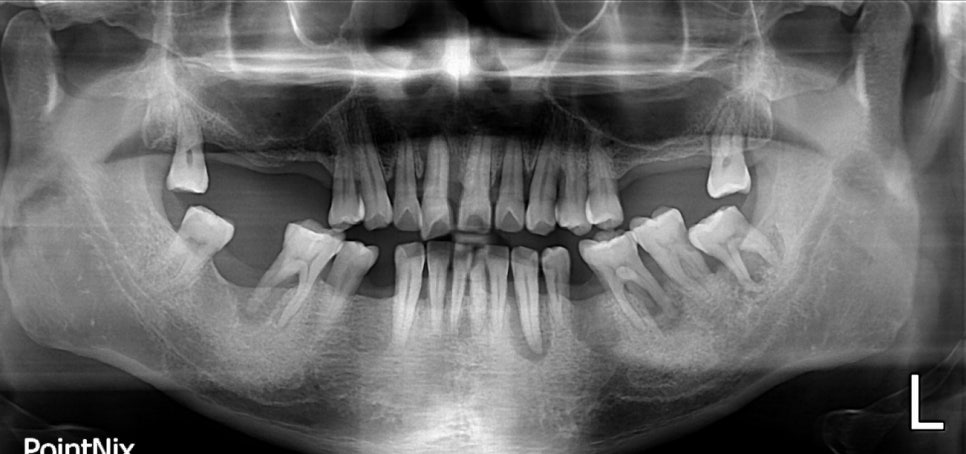 당뇨병과 잇몸병?(당뇨합병증 이겨내기) 관련 이미지 4
