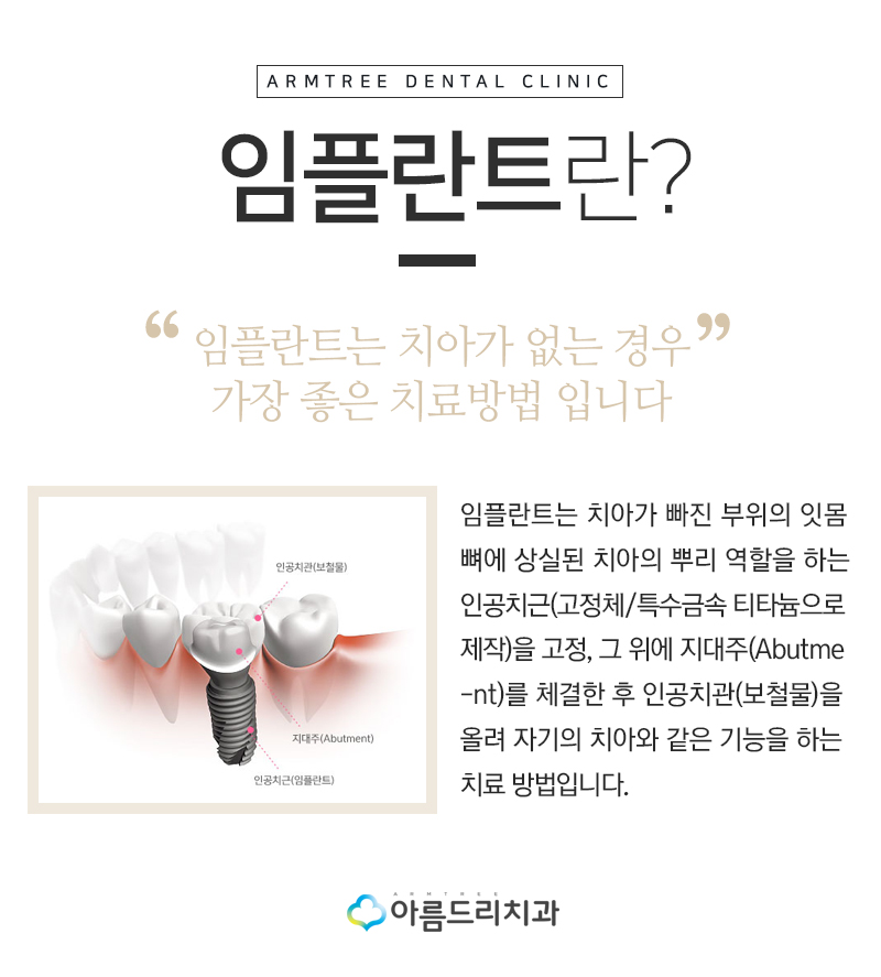 인플란트통증 디지털임플란트 좋은이유 관련 이미지 2