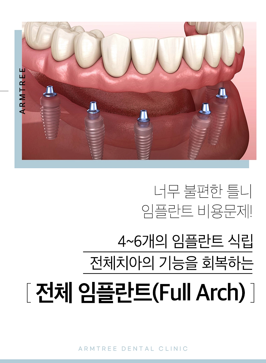 신논현역치과 전체임플란트가 궁금하다면 관련 이미지 2