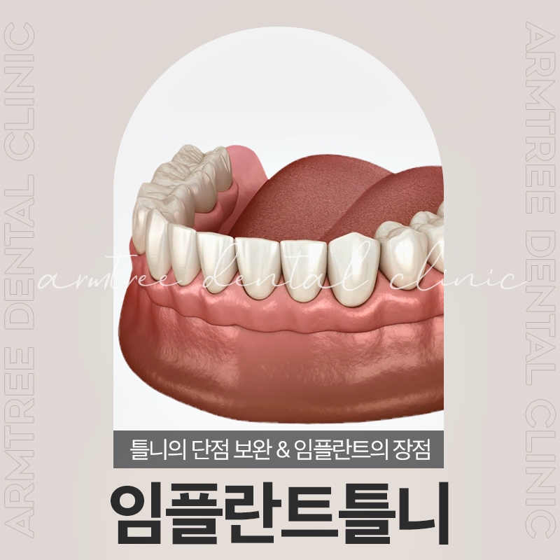 임플란트틀니 60세이상 치아가 신경쓰인다면 관련 이미지 1